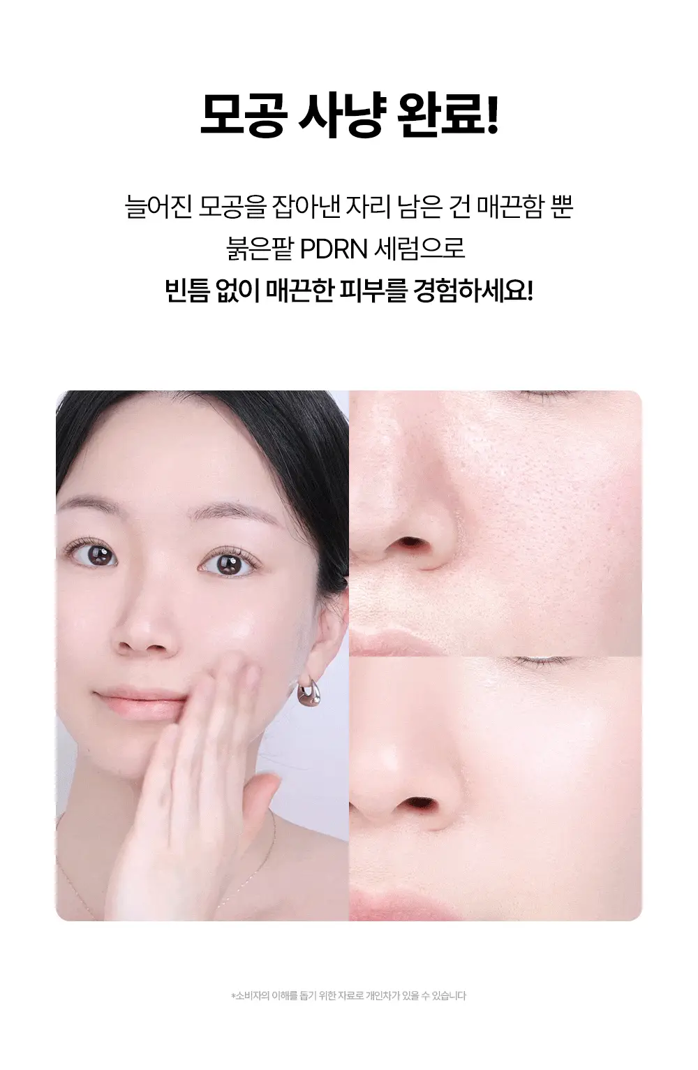 [단독/붓기완화] 조선미녀 붉은팥 PDRN 모공탄력 세럼 30ml 더블기획 상세페이지 7